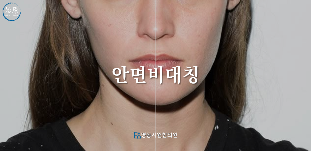 02-안면비대칭-메인이미지