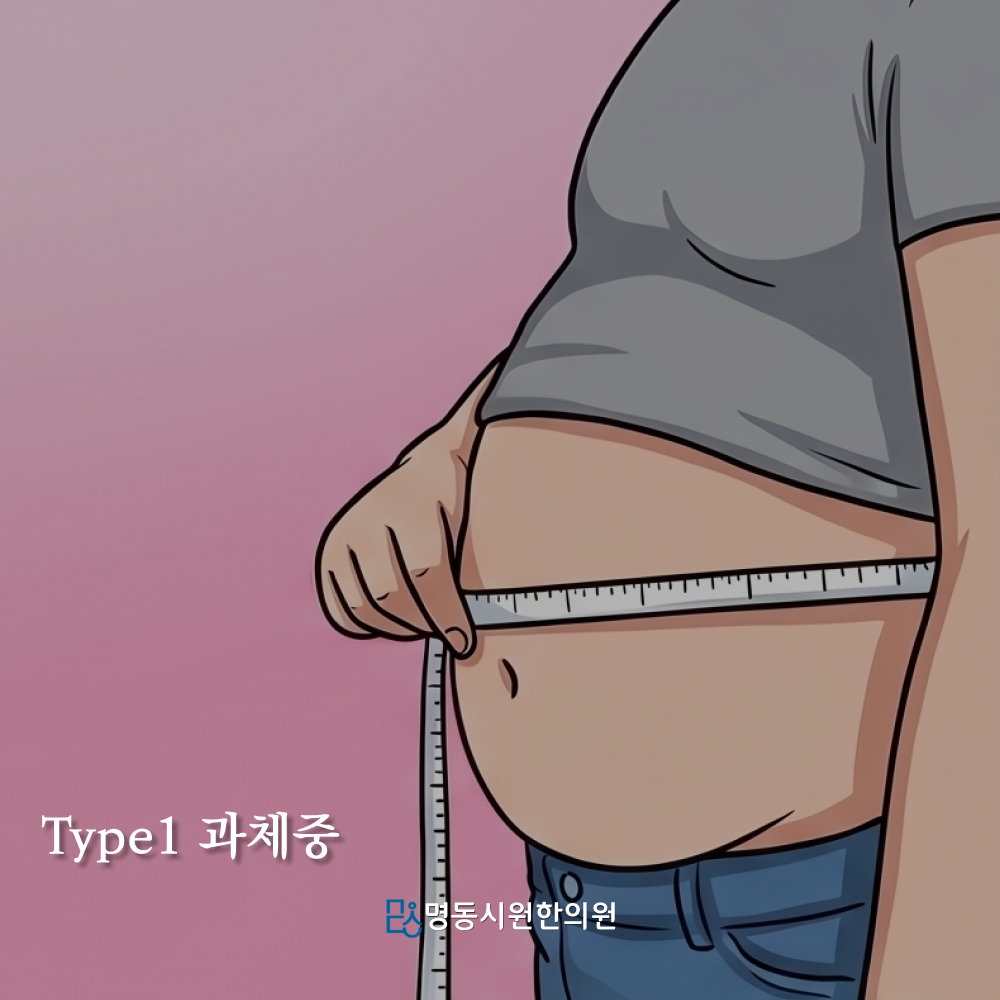 과체중형 체형 예시