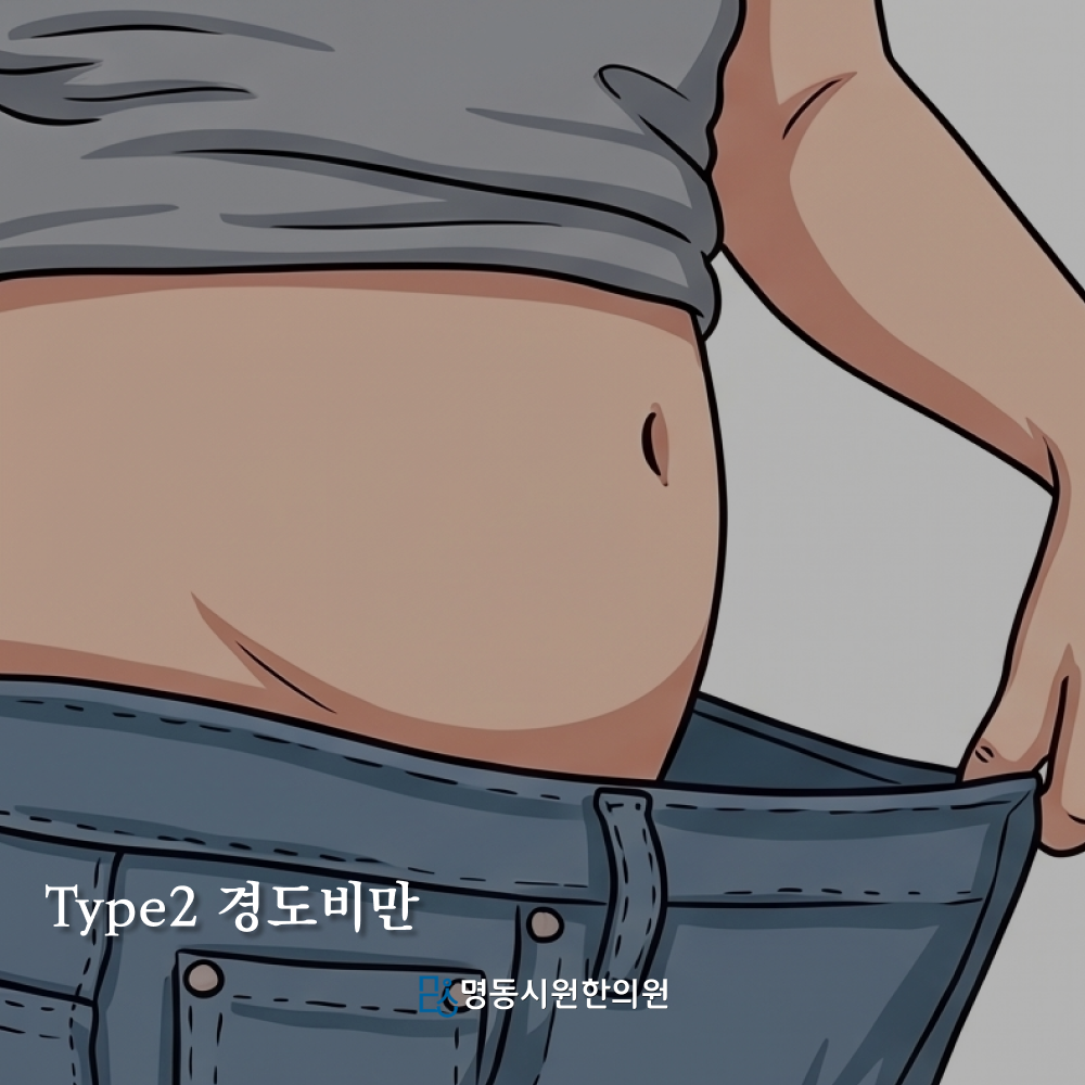 경도비만형 체형 예시