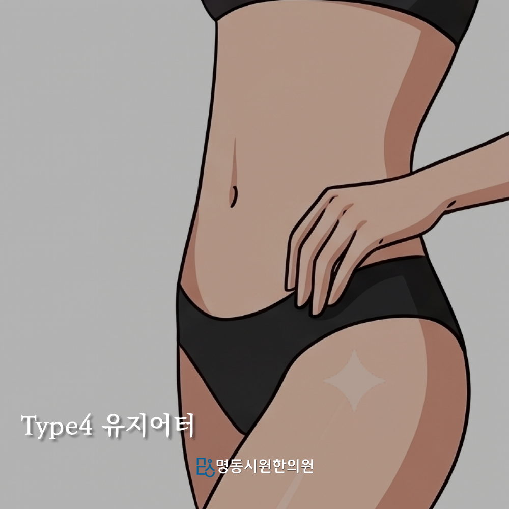 유지어터형 체형 예시